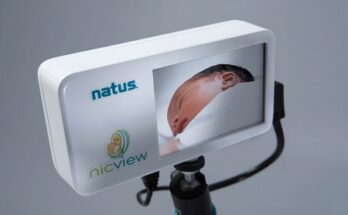 Enhancing Trust and Bonding in the NICU with NICVIEW