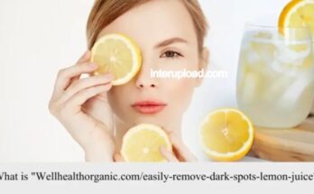 remove dark spots lemon juice